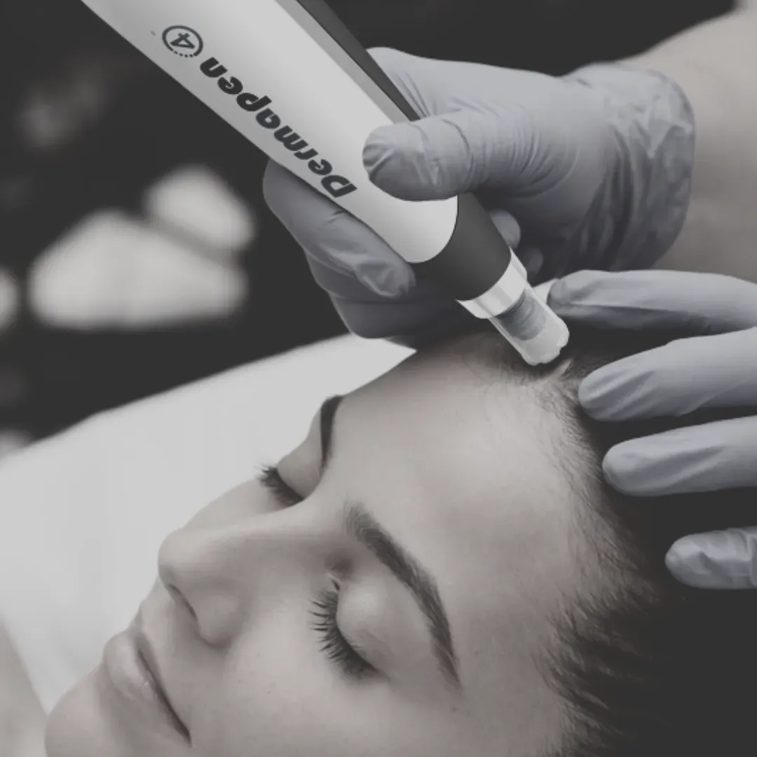 Skin Microneedling image