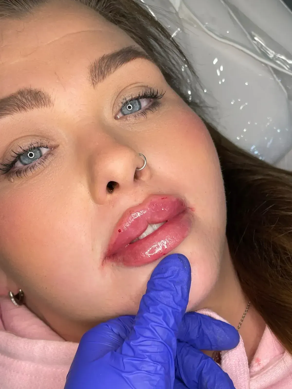 Facials