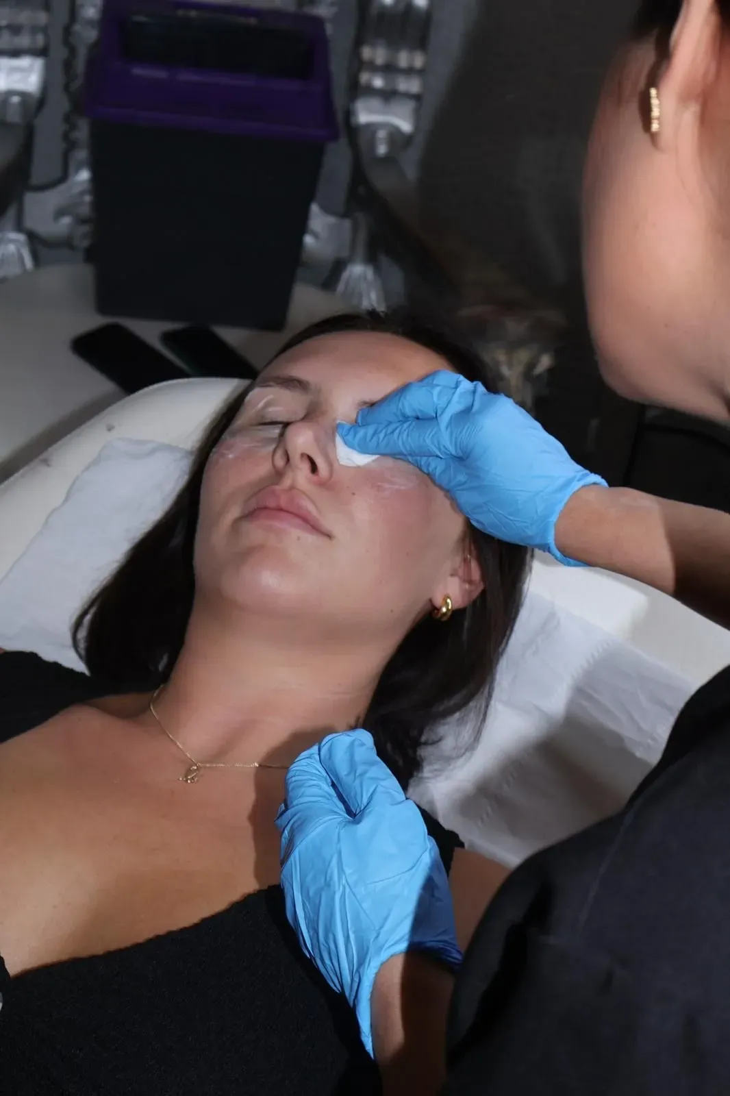 Chemical Peels image