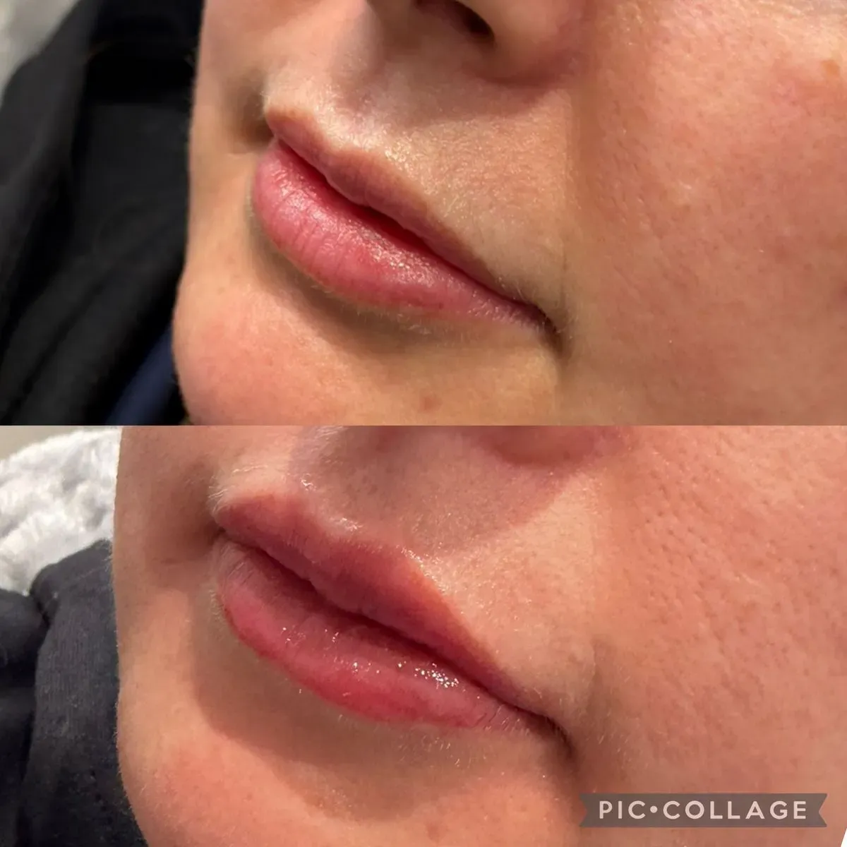 Dermal fillers image background image