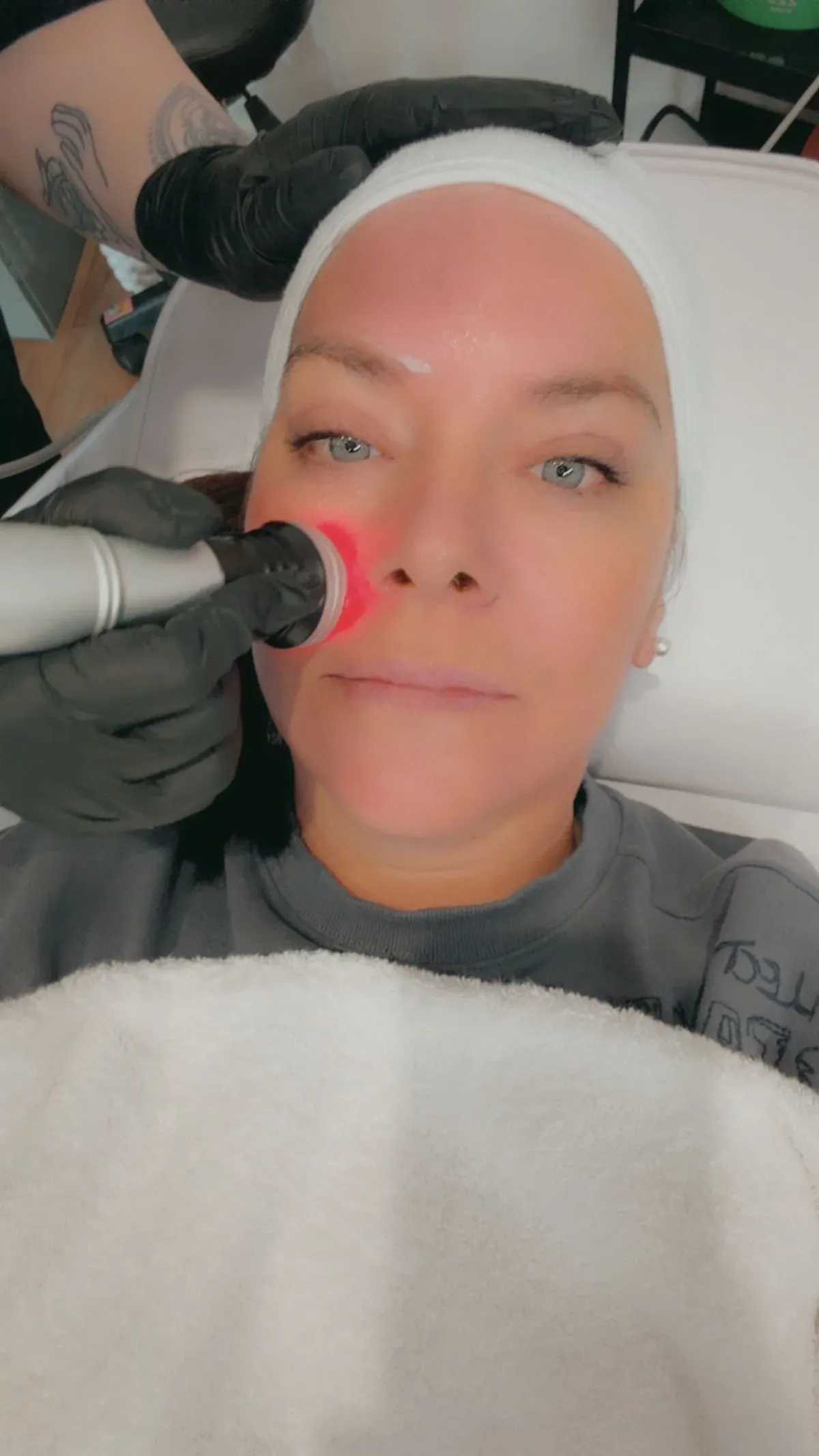 Microneedling image background image