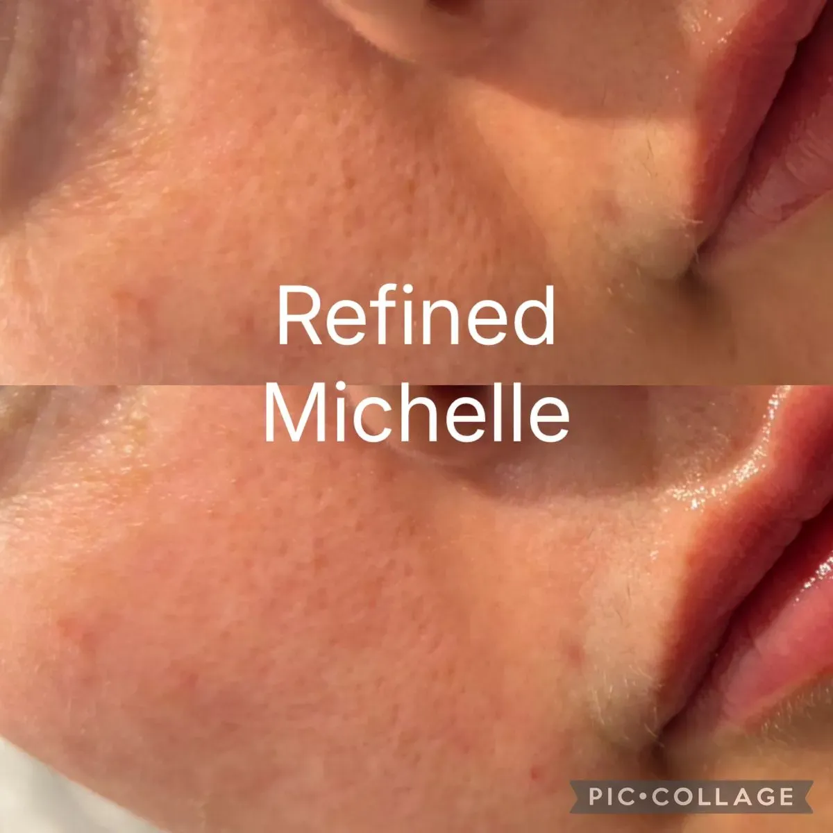 Skin rejuvenation treatments image background image