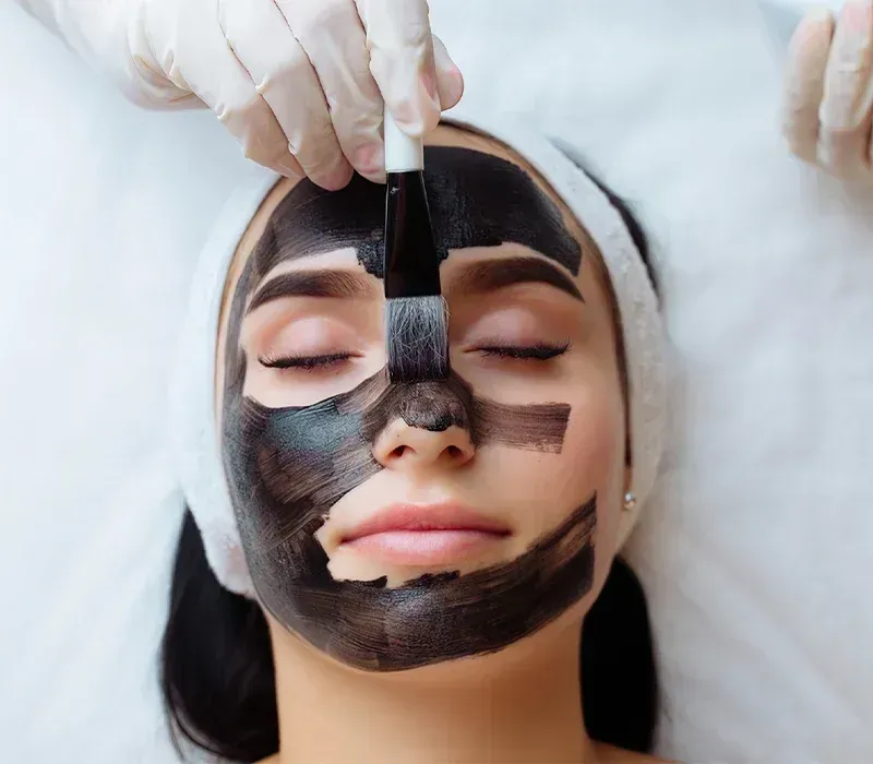 Carbon Peeling/Hollywood Peel image background image