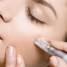 Chemical Peels
