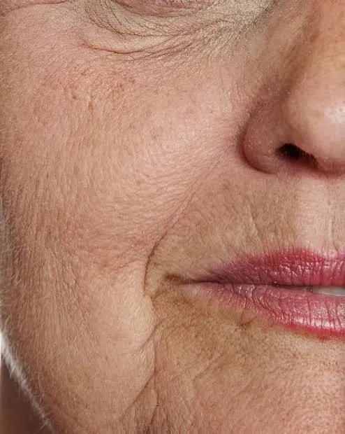 Anti-ageing treatments image background image
