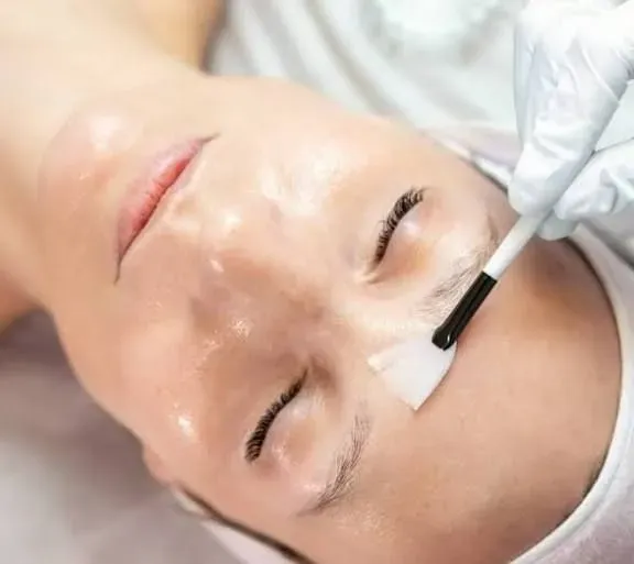 Chemical peels image background image