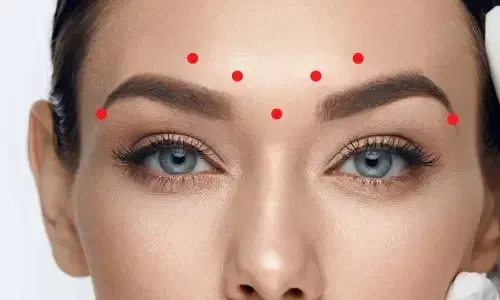 Laser Treatments