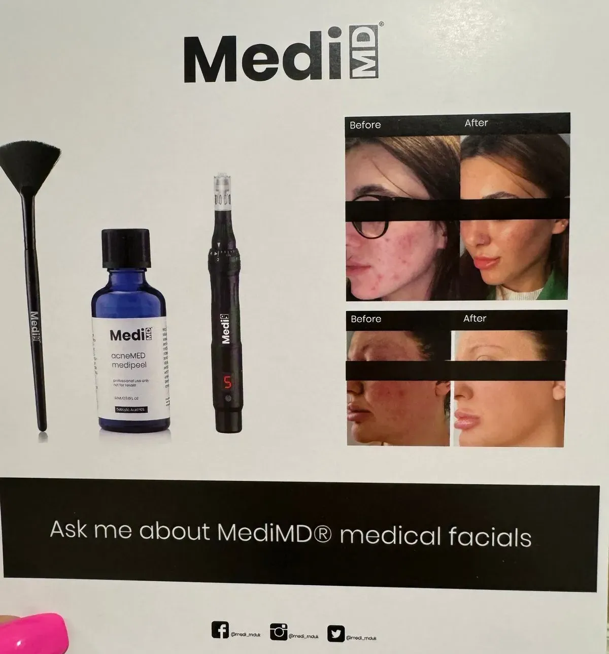 Chemical Peels image background image