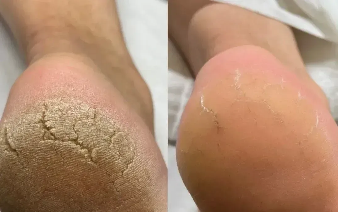 Medical Pedicure image