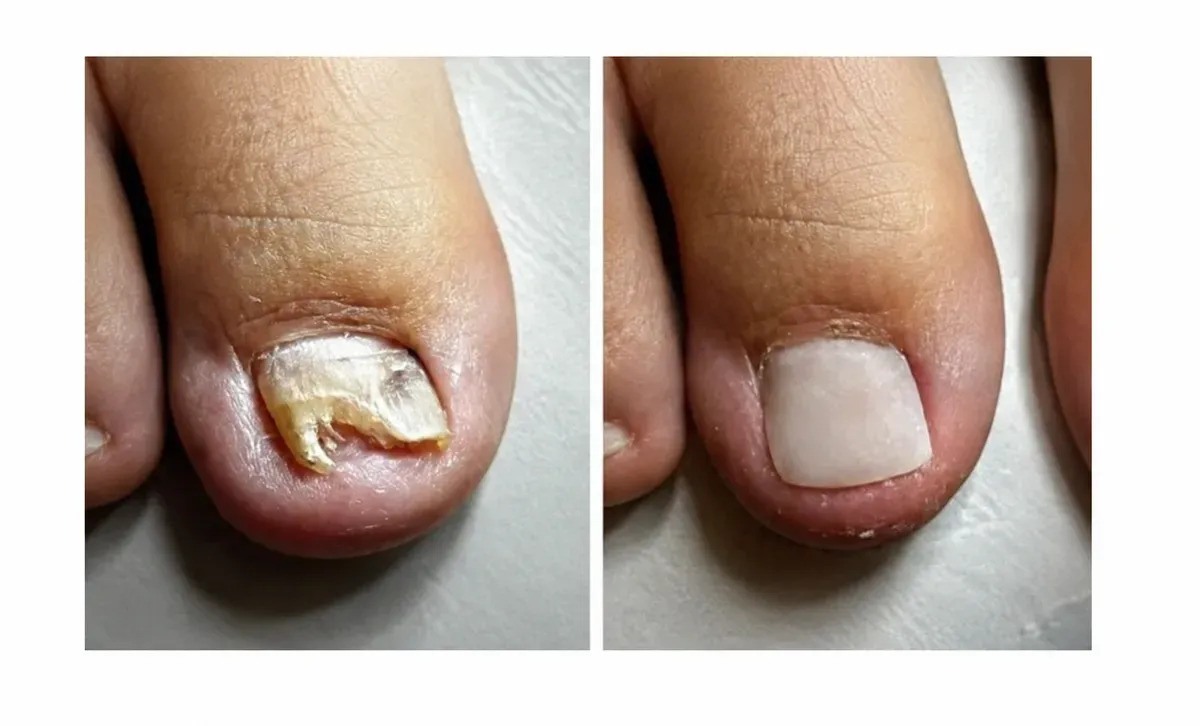 Medical Pedicure image
