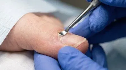Medical Pedicure image background image