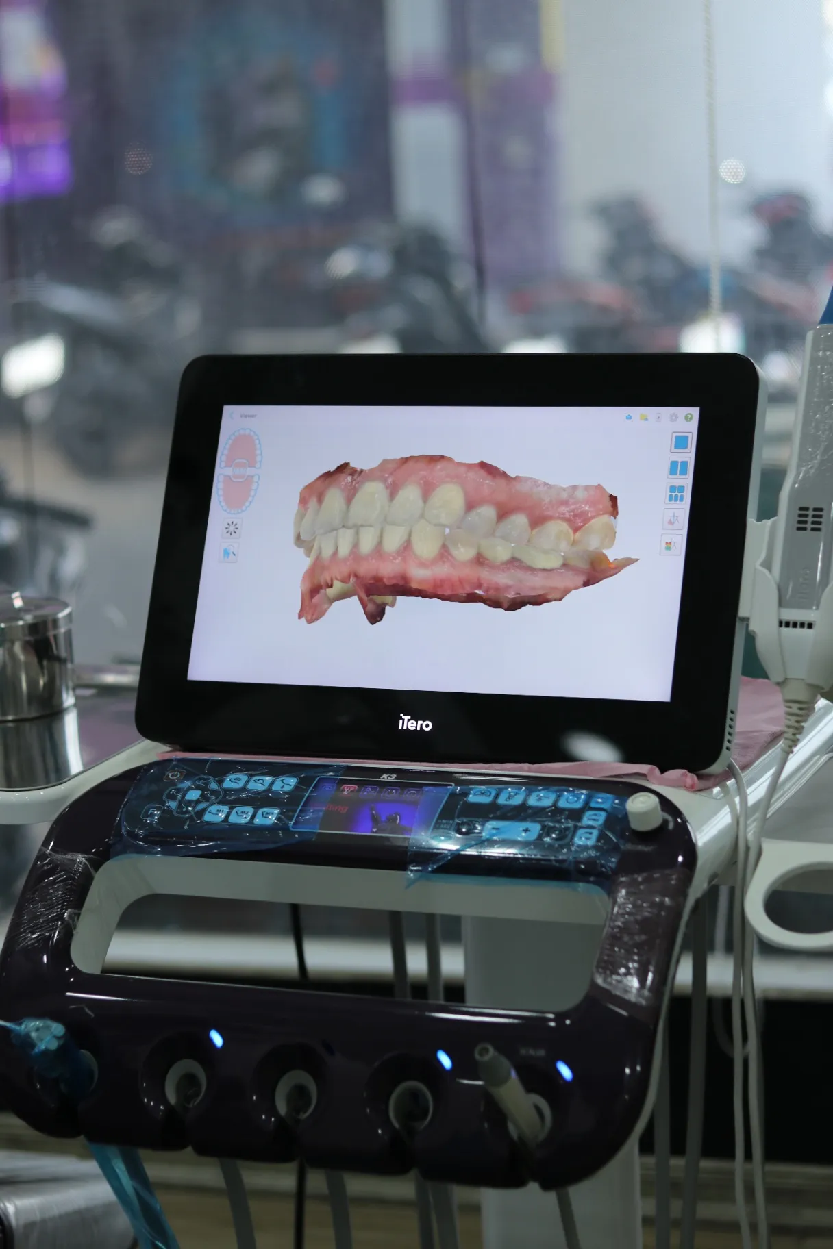 Máy Quét Dấu Hàm 3D iTero 5D Plus