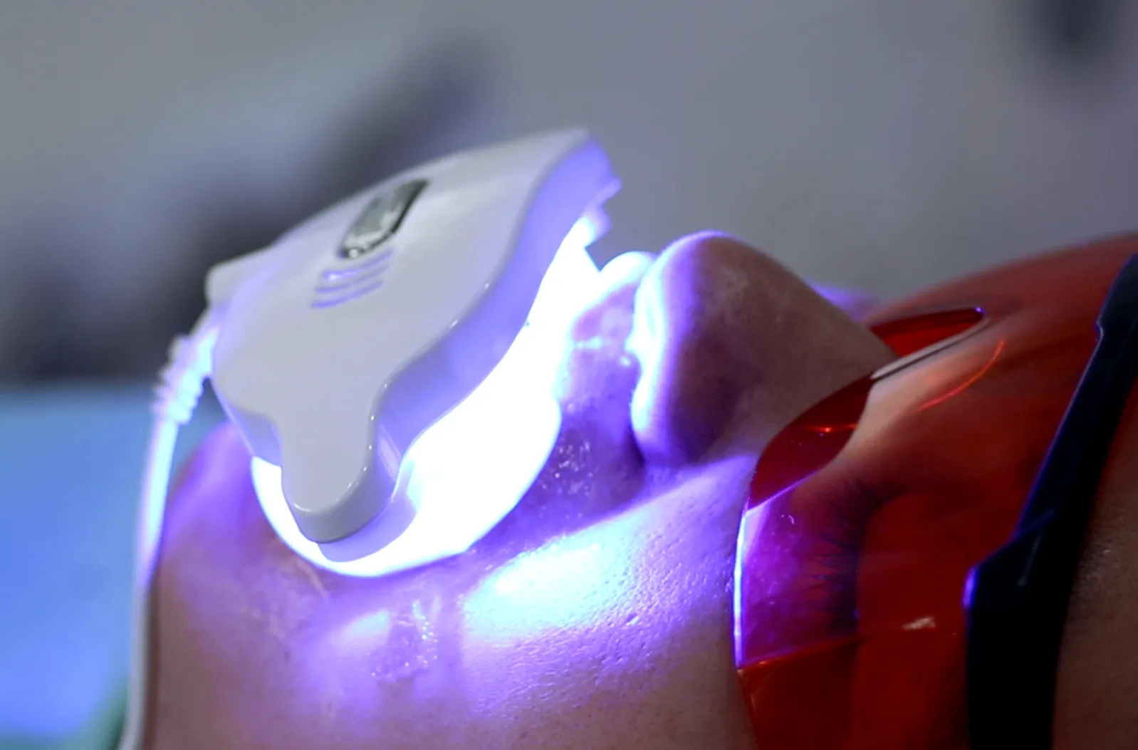Hệ Thống Đèn Tẩy Trắng Răng Laser / LED Quang Trực Tiếp