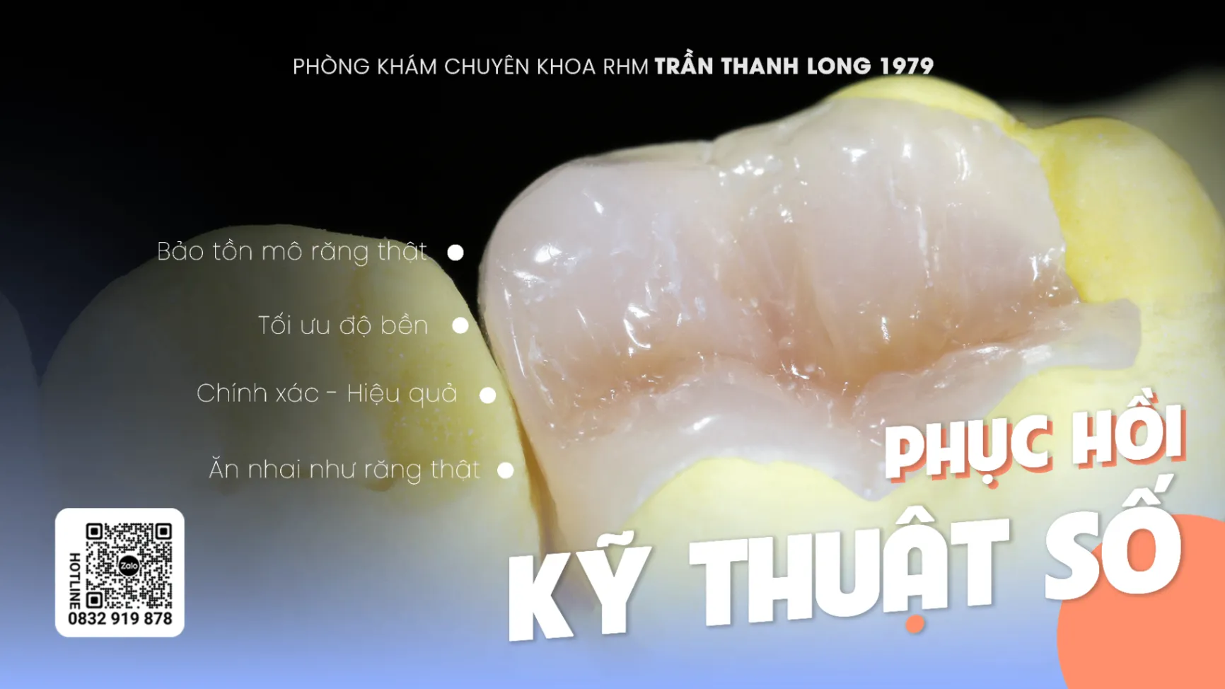 Phục hồi kỹ thuật số - Công nghệ điều trị và bảo tồn răng thật tối đa