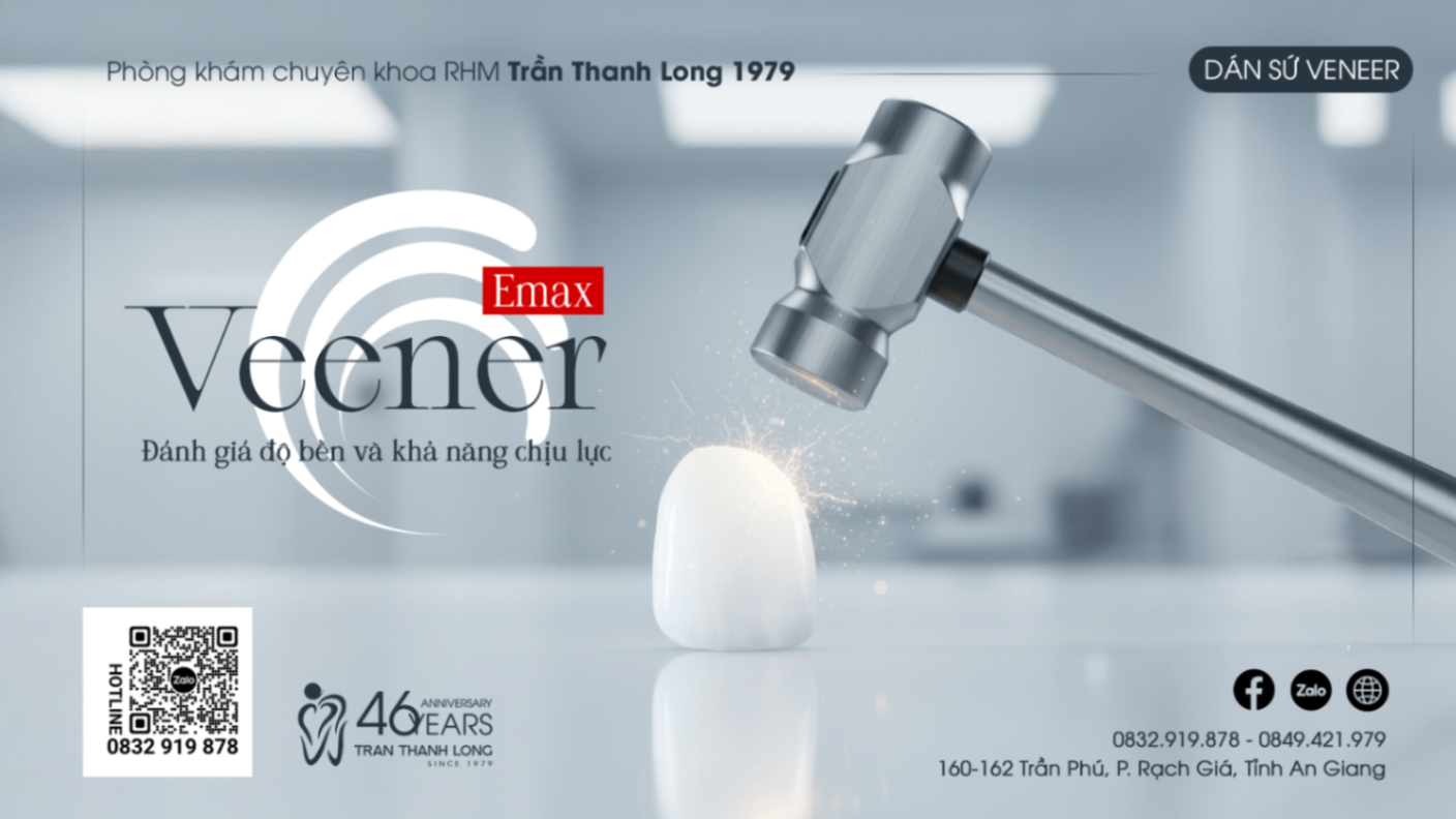 Veneer sứ Emax: Khả năng chịu lực và độ bền trong ăn nhai