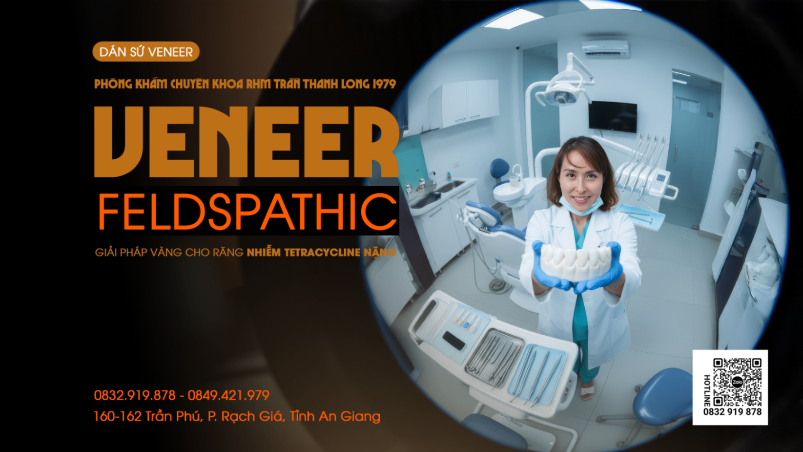 Dán Sứ Veneer Feldspathic: Giải Pháp Tối Ưu Cho Răng Nhiễm Tetracycline Nặng (Độ IV)