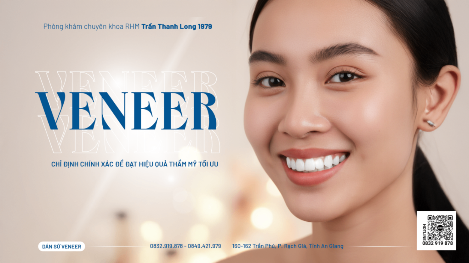 Khi Nào Cần Dán Sứ Veneer: Chỉ Định Chính Xác Để Đạt Hiệu Quả Thẩm Mỹ Tối Ưu