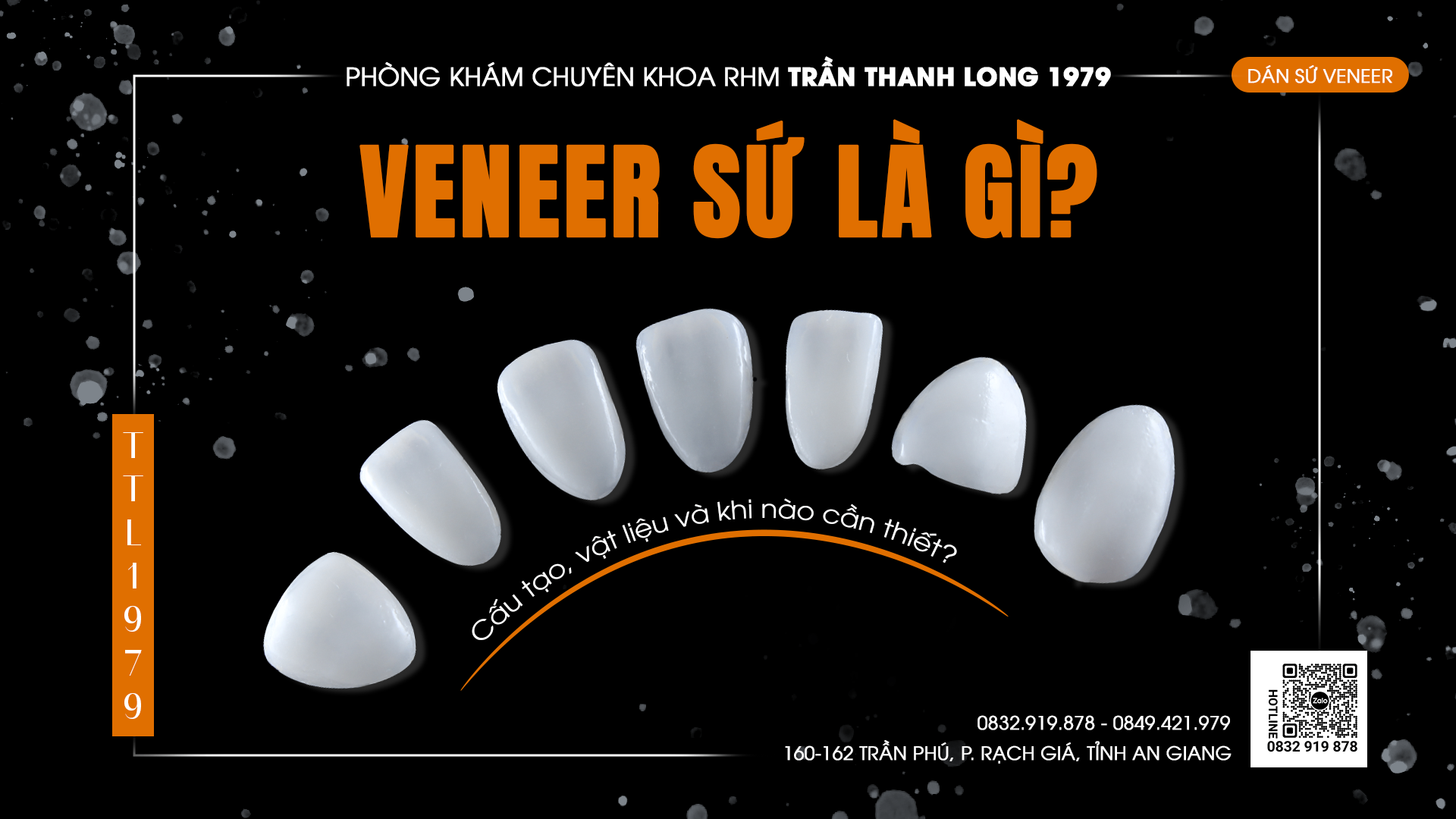 Dán Sứ Veneer: Định Nghĩa, Lịch Sử Hình Thành và Cấu Tạo Chi Tiết