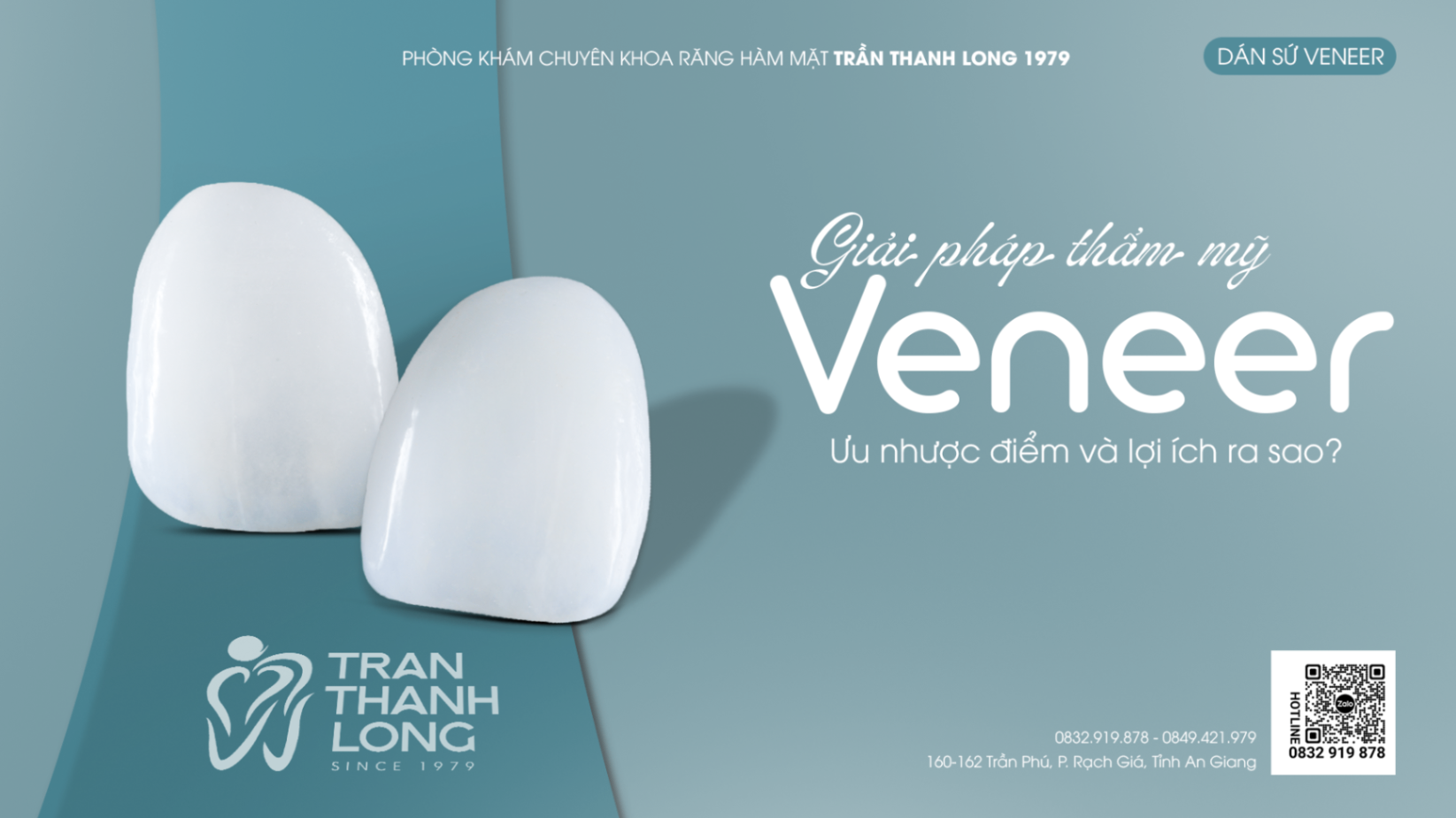 Dán Sứ Veneer Có Tốt Không? Ưu Nhược Điểm Và Lợi Ích Của Veneer