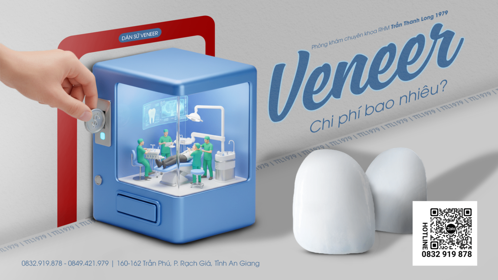 Dán Sứ Veneer Giá Bao Nhiêu 2026: Bảng Giá Chi Tiết Và Yếu Tố Quyết Định