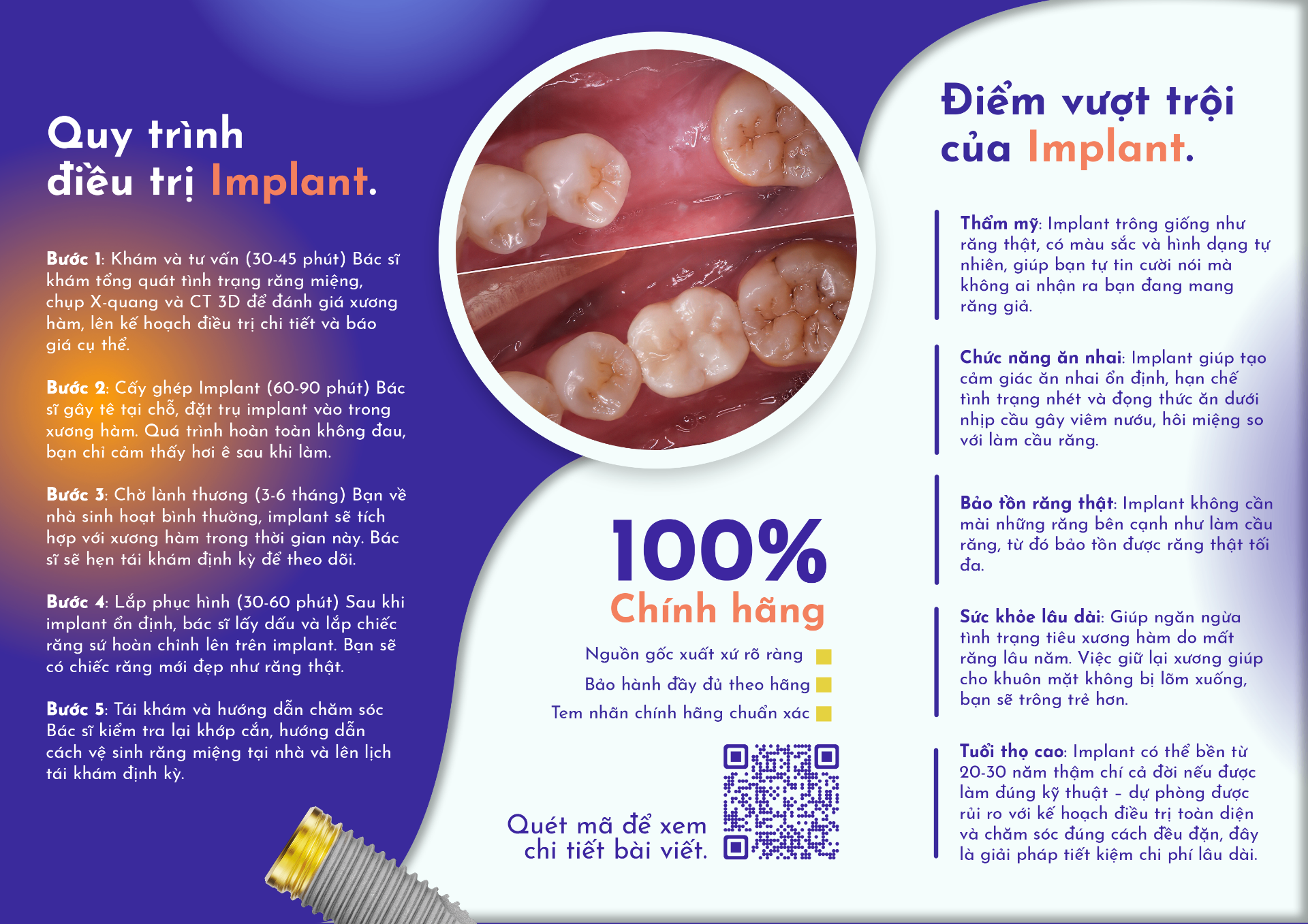 Implant
