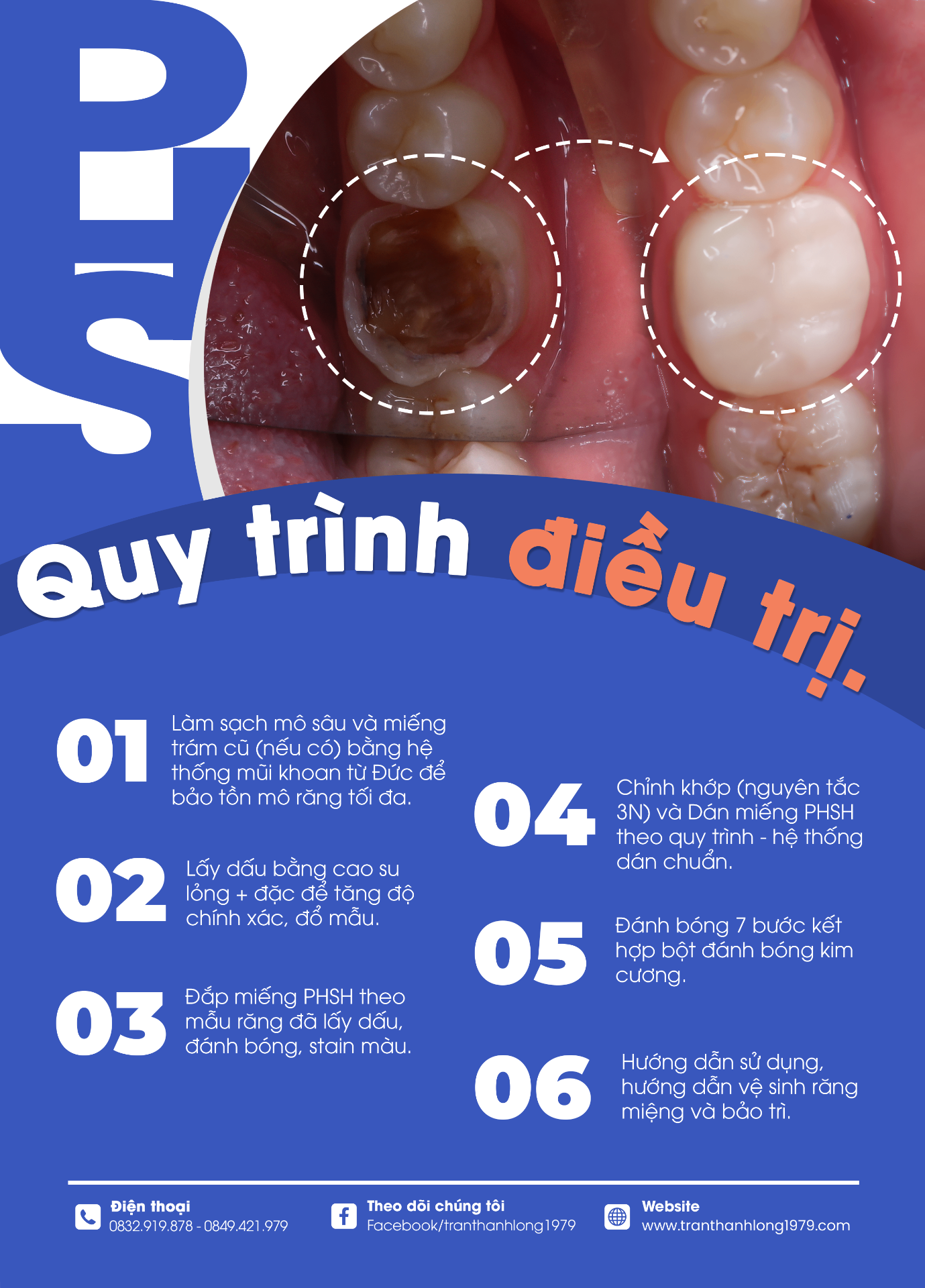 phuc hoi sinh hoc