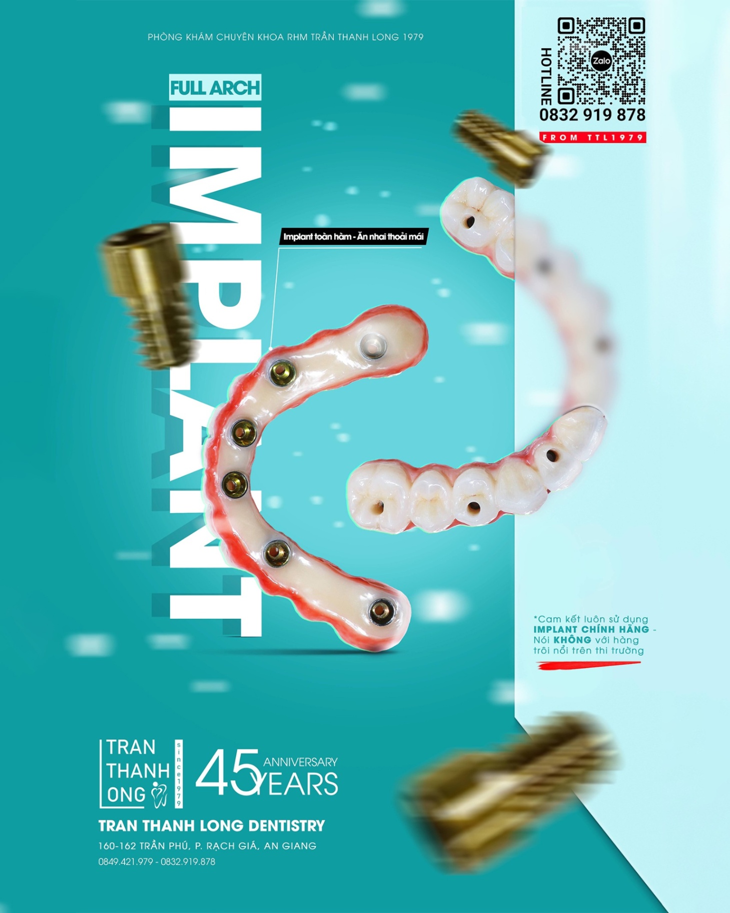 Implant Toàn Hàm
