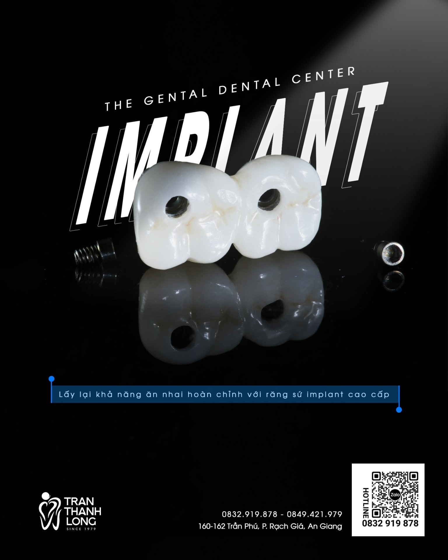 Implant Đơn Lẻ