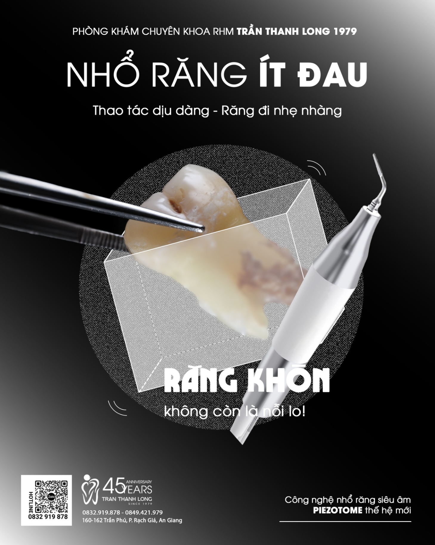 Nhổ răng