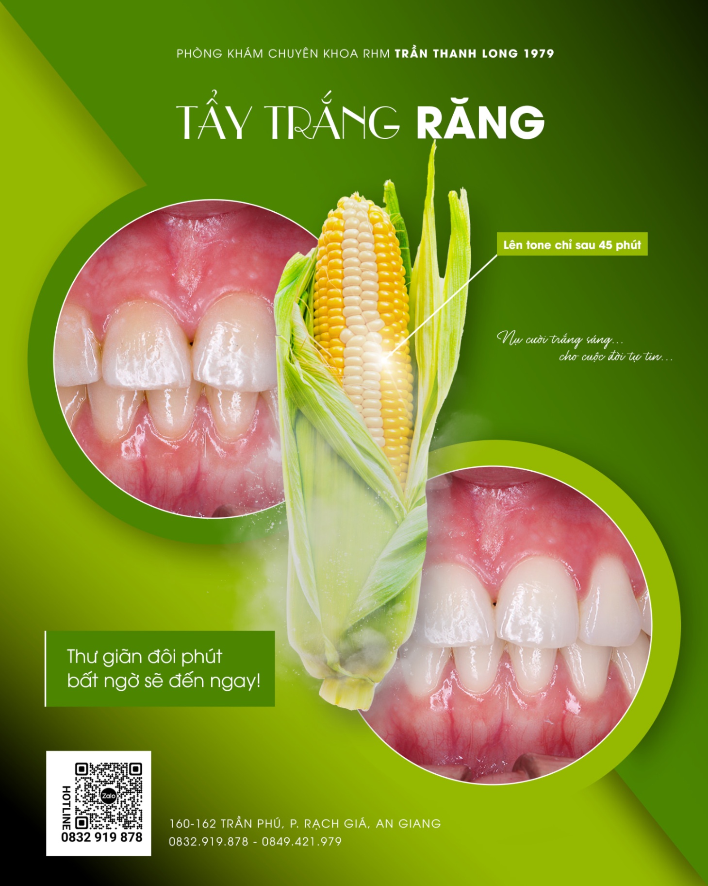 Tẩy trắng răng