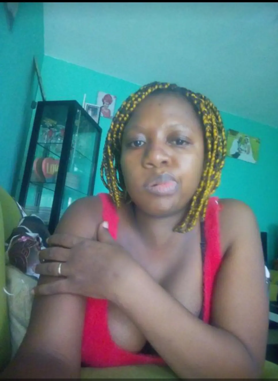 Prof des paralysies faciales - Other - Yaounde 2