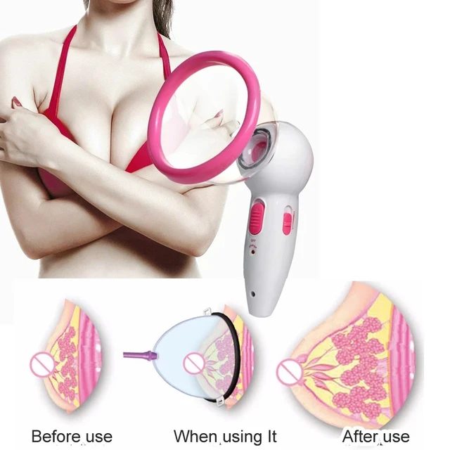 Breast enlargement device 