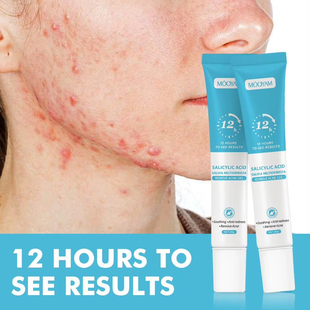 Gel anti-Acne à l'acide salicylique 