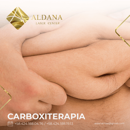 Carboxiterapia