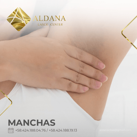 Eliminación de Manchas