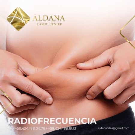 Radiofrecuencia