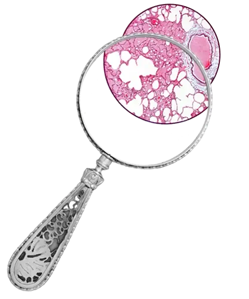 Metal magnifying glass