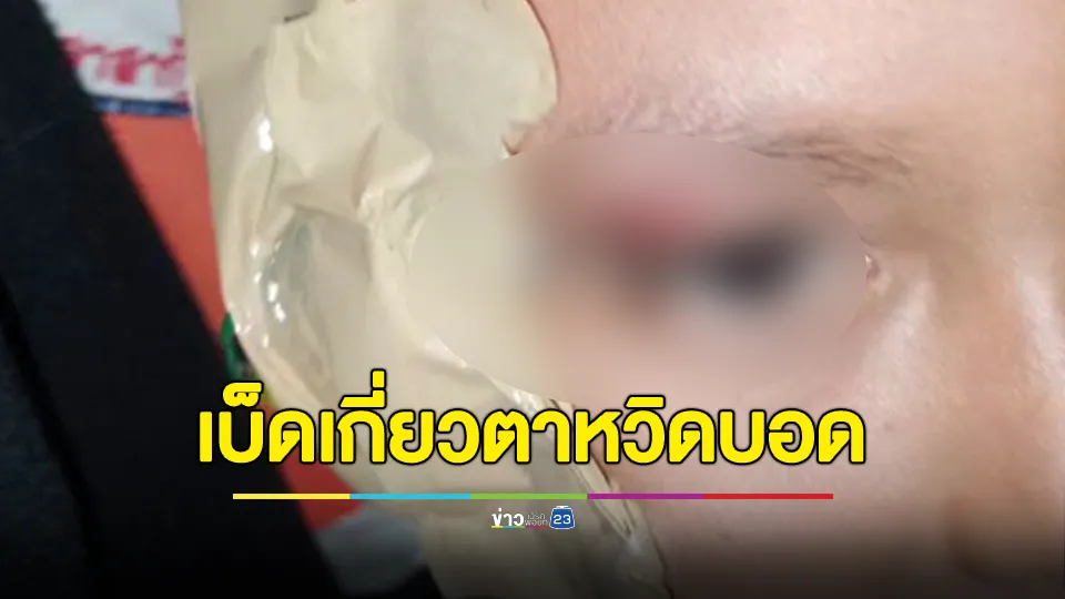 อุทาหรณ์! หนูน้อยวัย 8 ขวบ ไปตกปลาพลาดถูกเบ็ดเกี่ยวตาหวิดบอดกลางทุ่งนา