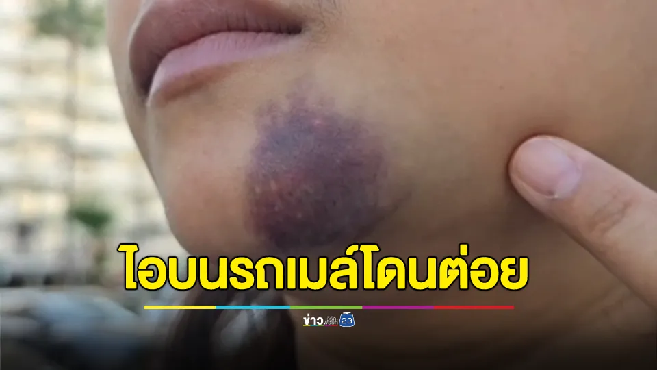 สาวห้างดังไอกะแอมบนรถเมล์ โดนชายอายุราว 40 ปีรัวหมัดซัดคางช้ำ