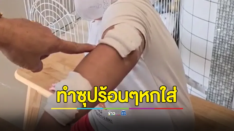 หัวอกแม่ระทม! พนักงานร้านอาหารทำน้ำซุปหกลวกใส่ลูกวัย 4 ขวบ บาดเจ็บ 