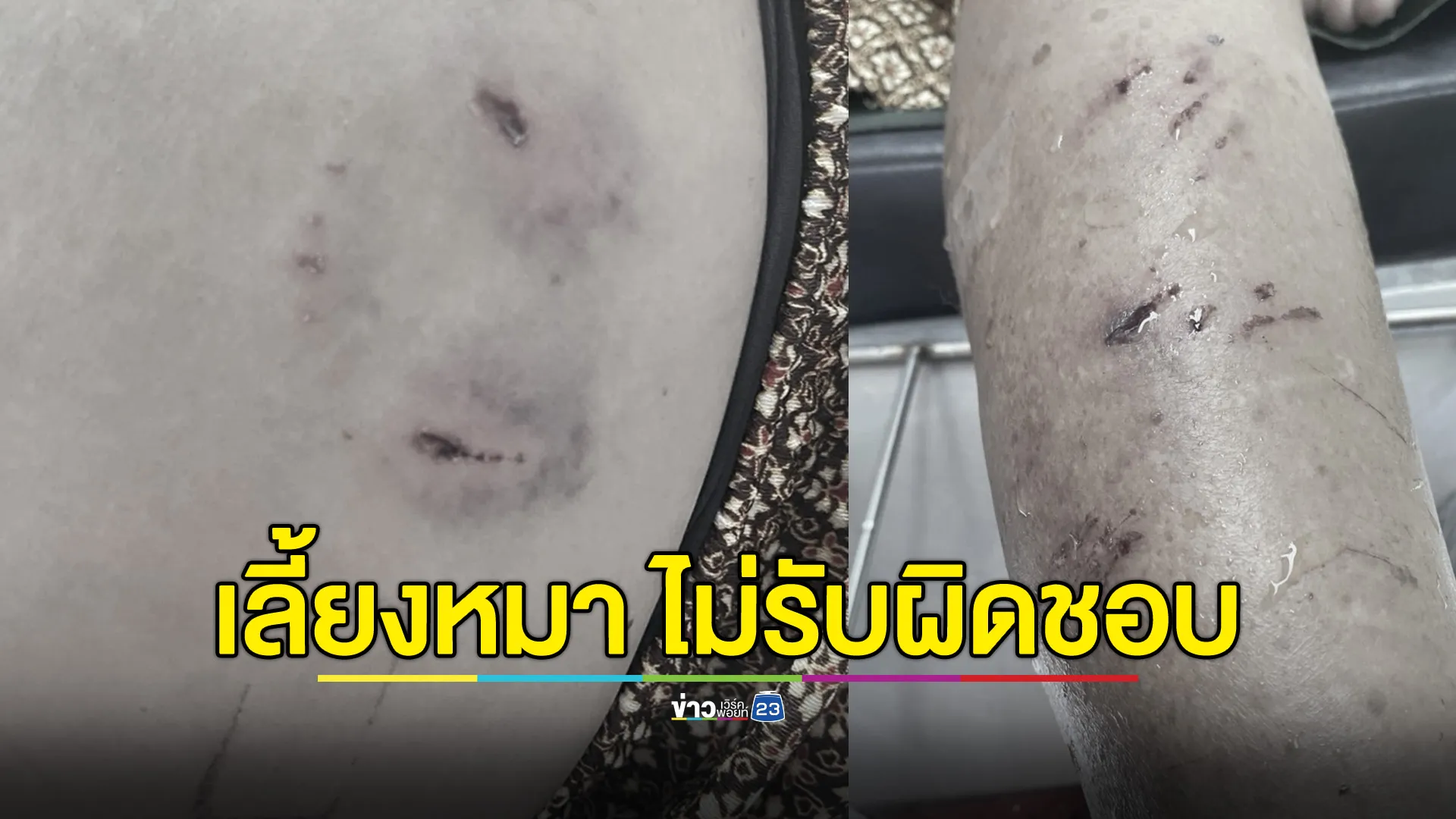 เลี้ยงหมานับสิบตัว กัดชาวบ้านเจ็บถ้วนหน้า แต่เจ้าของหมาปัดความรับผิดชอบ อ้างเสียอารมณ์ เพราะชาวบ้านพูดมาก