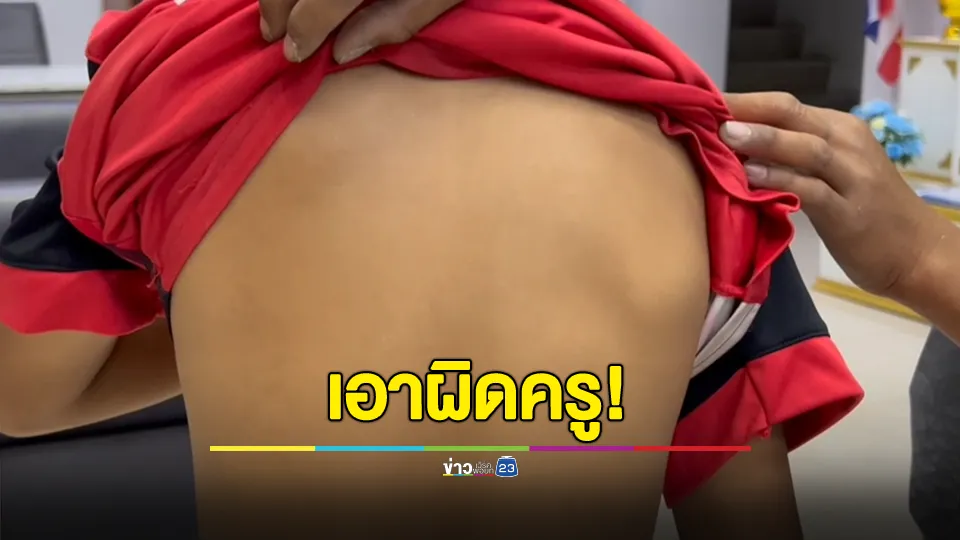 พ่อแม่พาลูกแจ้งความ หลังถูกครูใช้ไม้พลองตีจนไม้หัก 