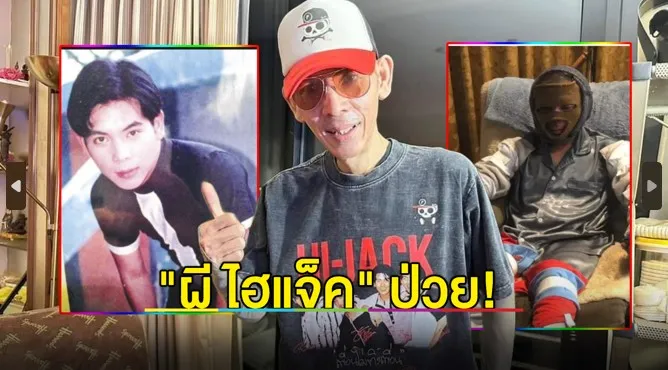 กำลังใจแน่น "ผี ไฮแจ็ค" สัญญาจะหายจากโรคตุ่มน้ำพอง!