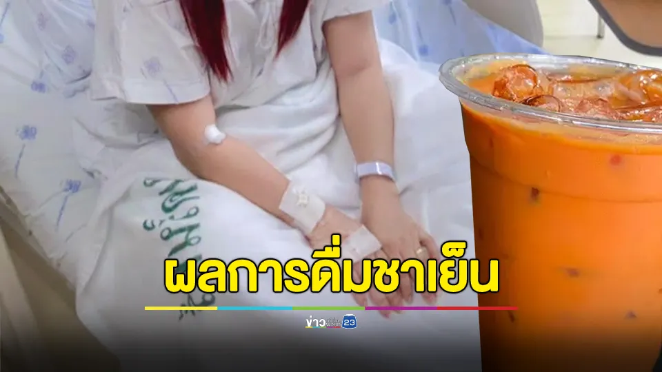 สาวแชร์อุทาหรณ์! ผลของการดื่มชาเย็นทุกวัน ไม่เน้นดื่มน้ำเปล่า สุดท้ายพบก้อนนิ่วในกรวยไตขนาดใหญ่ 