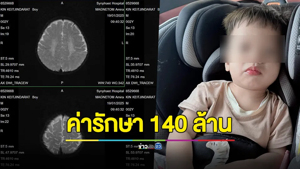 ขอให้มีปาฏิหาริย์! หนูน้อย 2 ขวบ ป่วยโรคหายาก ค่ารักษาสูงถึง 140 ล้าน