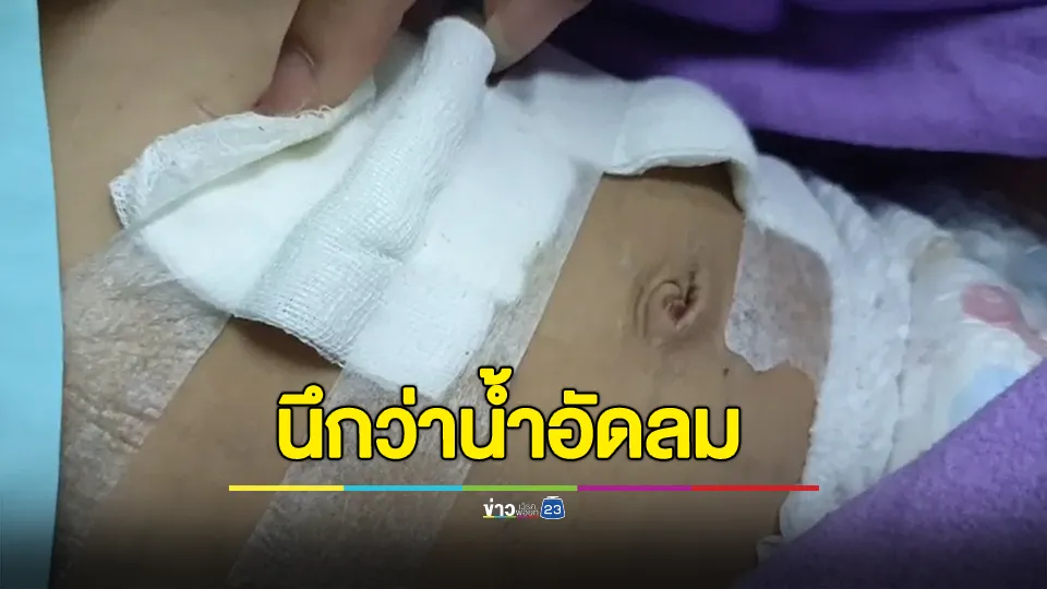 เตือน! ด.ช.4 ขวบ เผลอยกขวดน้ำอัดลมที่บรรจุน้ำกรดหยอดยางเจ็บสาหัส ตัดกระเพาะและลำไส้บางส่วนออก