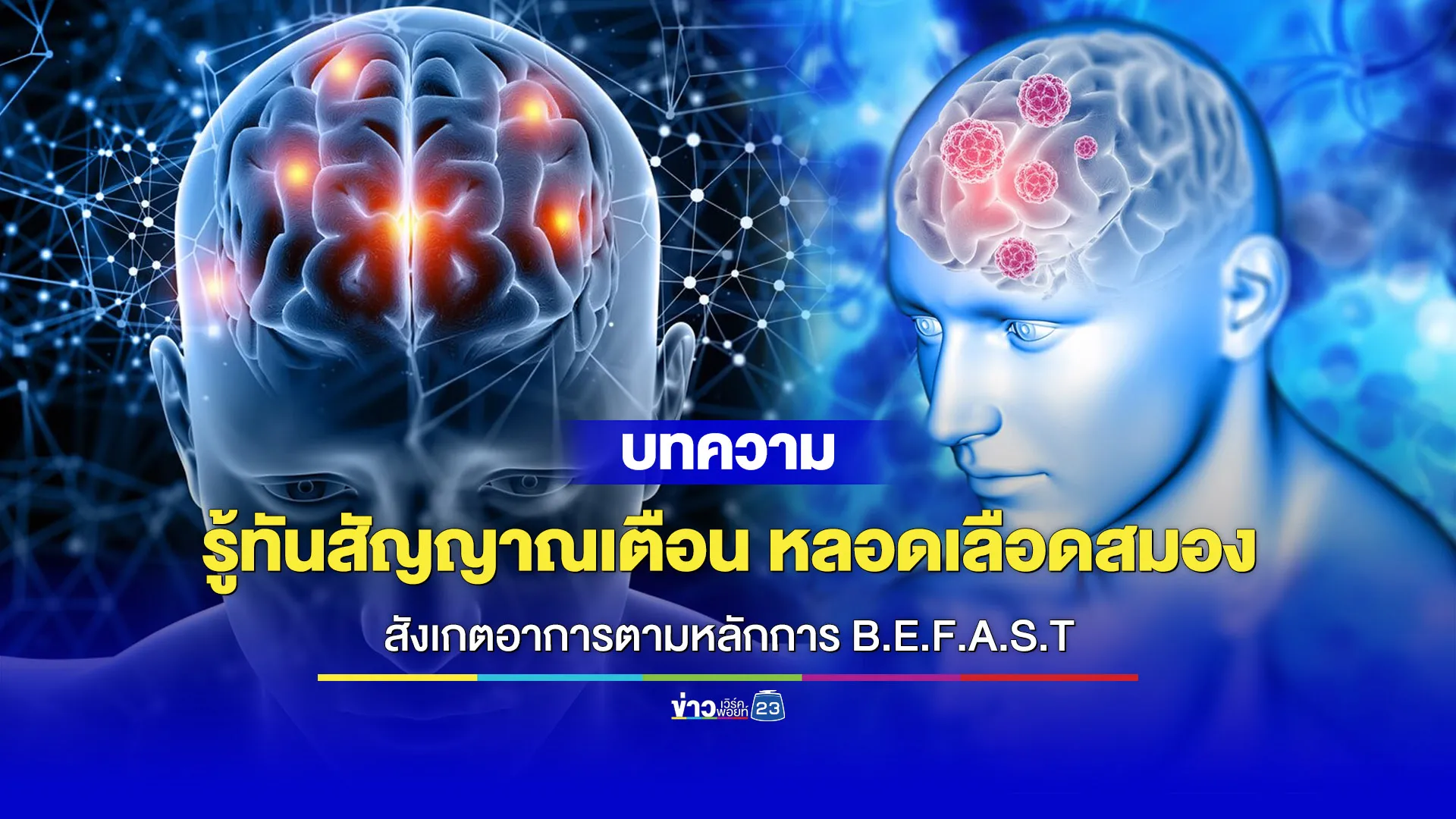 “โรคหลอดเลือดสมอง” สังเกตอาการเร็ว ลดความรุนแรงได้