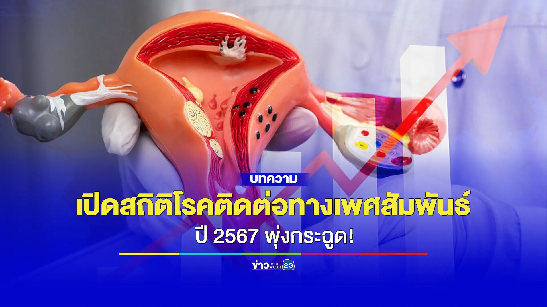 สถิติโรคติดต่อทางเพศสัมพันธ์พุ่งกระฉูด เลือกใช้ถุงยางให้ถูกต้องลดความเสี่ยง