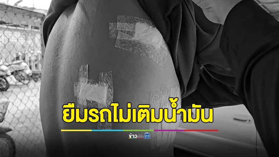 หนุ่มวัย 20 ปี ถูกเพื่อนเก่ายกพวกมารุมฟันบาดเจ็บ 