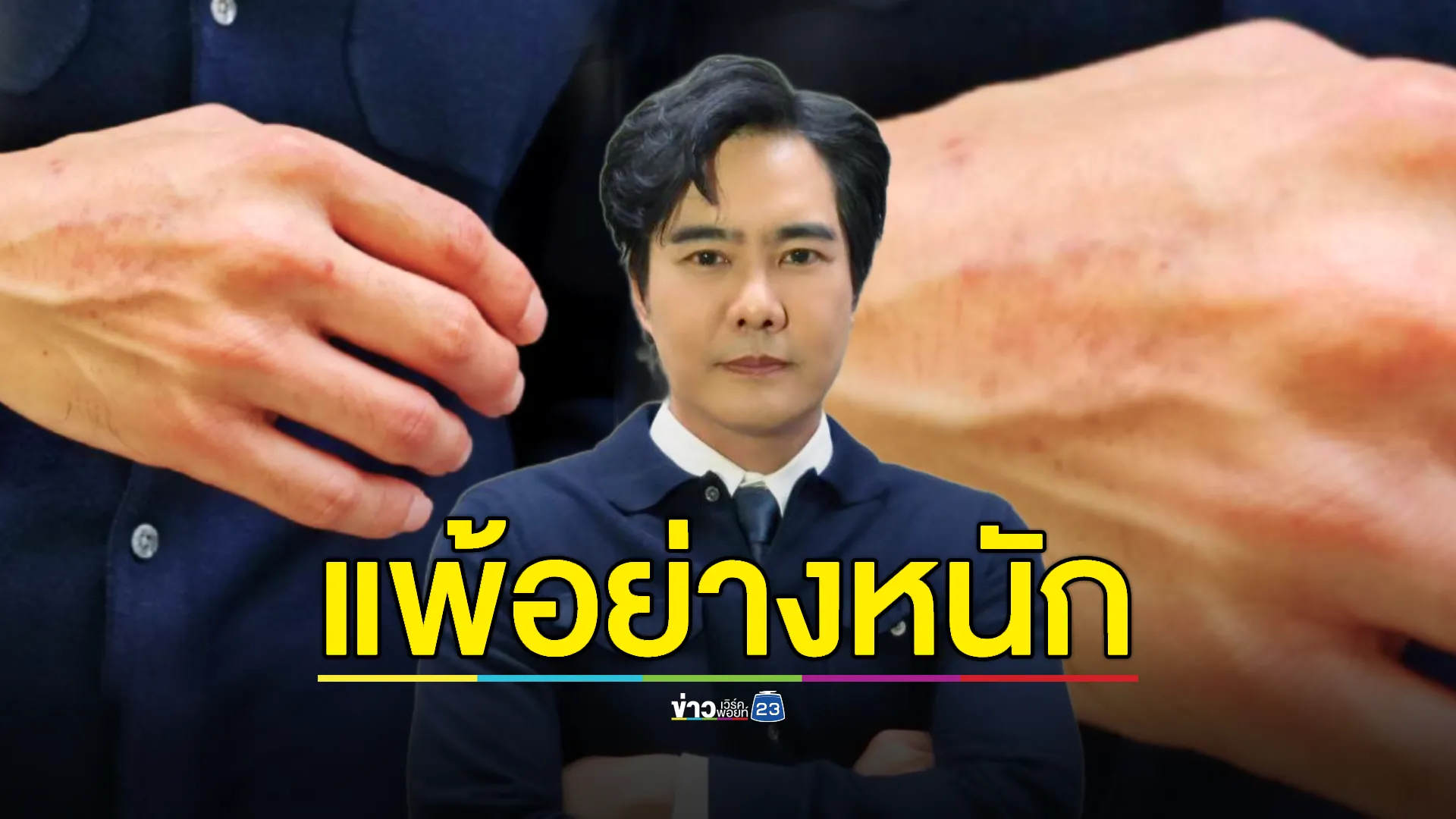 “เคลลี่” เร่งทำบ้าน! เกิดอาการแพ้-รอยแดงขึ้นตามตัว